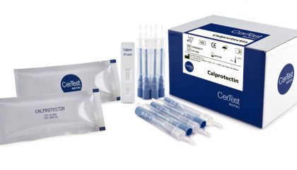 Calprotectin Rapid test